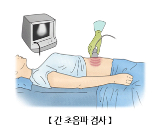 간초음파검사